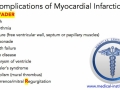 Complications of Myocardial Infarction (MI) mnemonic