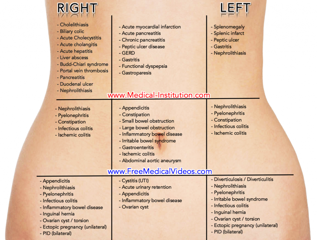 Abdominal Quadrant Chart