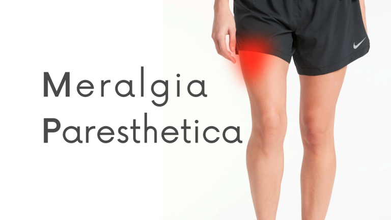 Meralgia Paresthetica Causes, Symptoms, Diagnosis, Treatment, Hip Pain Causes, Thigh Pain Causes | www.DailyMedEd.com